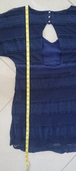 Chaser Navy Boho Open Back Mini Dress | Size M | 100% Cotton Resortwear